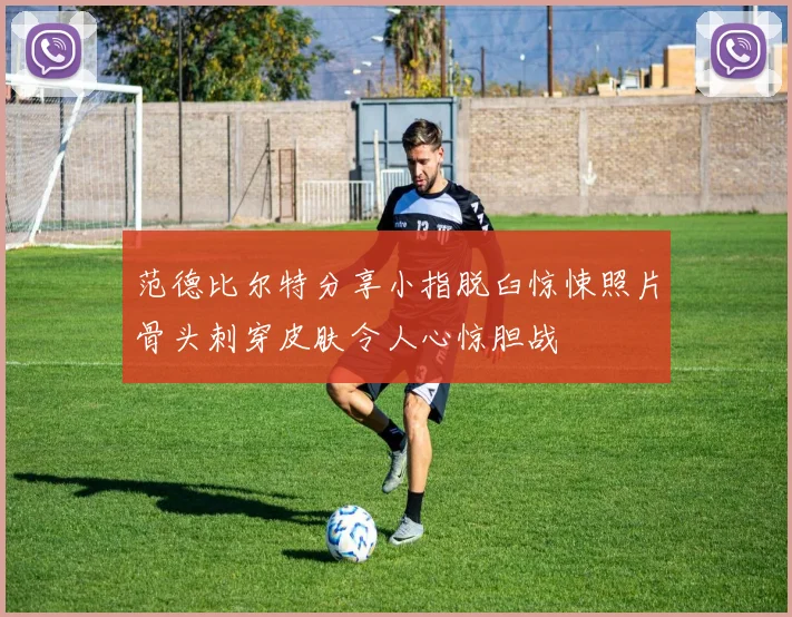 范德比尔特分享小指脱臼惊悚照片骨头刺穿皮肤令人心惊胆战